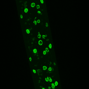 <b>Fluorescent Tagging. </b>IIntestinal nuclei from late L4 worms in an lmn-1::GFP transgenic strain. Image courtesy of Dr. André Catic, Baylor College of Medicine.
