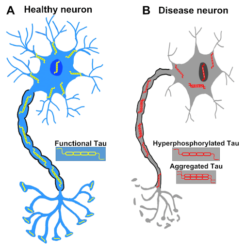 healthy neuron